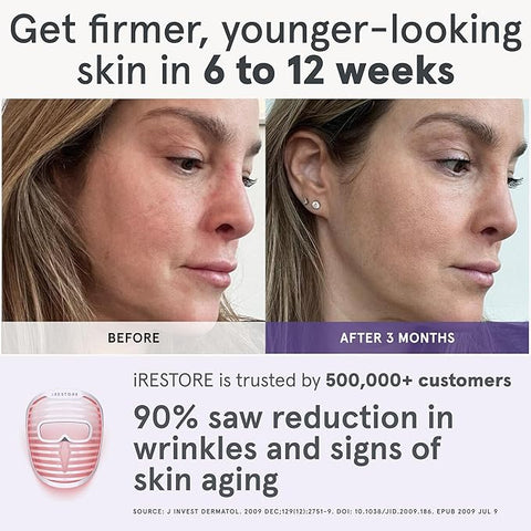 iRestore LED Face Mask Light Therapy